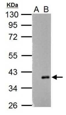 Western Blot: ARPC1A Antibody [NBP2-15470] - Sample (30 ug of whole cell lysate) A: Non-transfected 293T lysates B: ARPC1A transfected 293T lysate 10% SDS PAGE gel, diluted at 1:5000.