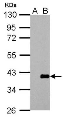 Western Blot ARPC1A Antibody - BSA Free
