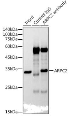 Immunoprecipitation: ARPC2 Antibody (4F2G6) [NBP3-15471] - Immunoprecipitation analysis of 300ug extracts of HepG2 cells using 3ug ARPC2 antibody (NBP3-15471). Western blot was performed from the immunoprecipitate using ARPC2 antibody (NBP3-15471) at a dilition of 1:1000.