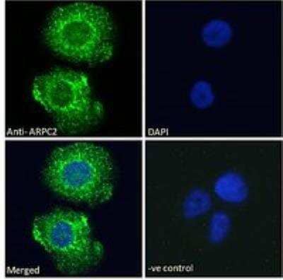 Immunocytochemistry/Immunofluorescence: ARPC2 Antibody [NB100-1037] - Immunofluorescence analysis of paraformaldehyde fixed A431 cells, permeabilized with 0.15% Triton. Primary incubation 1hr (10 ug/mL) followed by Alexa Fluor 488 secondary antibody (2 ug/mL), showing cytoplasmic staining. The nuclear stain is DAPI (blue). Negative control: Unimmunized goat IgG (10 ug/mL) followed by Alexa Fluor 488 secondary antibody (2 ug/mL).