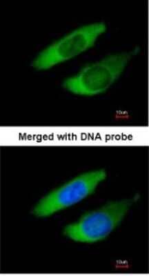 Immunocytochemistry/Immunofluorescence: ARPC2 Antibody [NBP1-32297] - Paraformaldehyde-fixed HeLa, using antibody at 1:200 dilution.