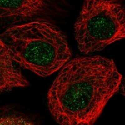 Immunocytochemistry/Immunofluorescence: ARPC2 Antibody [NBP3-17804] - Staining of human cell line A-431 shows localization to nucleoplasm.