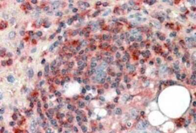 Immunohistochemistry-Paraffin: ARPC2 Antibody [NB100-1037] - Staining of Human Spleen. Steamed antigen retrieval with citrate buffer pH 6, AP-staining. Antibody at 3.8 ug/mL.