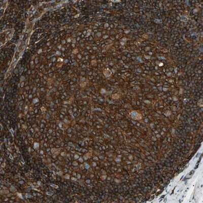 Immunohistochemistry-Paraffin: ARPC2 Antibody [NBP1-88852] - Staining of human lymph node shows strong cytoplasmic positivity in reaction center cells.