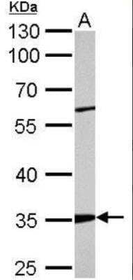 Western Blot: ARPC2 Antibody [NBP1-32297] - A. 50 ug Mouse kidney lysate/extract 10% SDS-PAGE ARPC2 antibody dilution: 1:2000 The HRP-conjugated anti-rabbit IgG antibody (NBP2-19301) was used to detect the primary antibody.