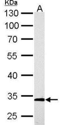 Western Blot: ARPC2 Antibody [NBP1-32297] - A. 50 ug Rat kidney lysate/extract 10% SDS-PAGE ARPC2 antibody  dilution: 1:5000 The HRP-conjugated anti-rabbit IgG antibody (NBP2-19301) was used to detect the primary antibody.