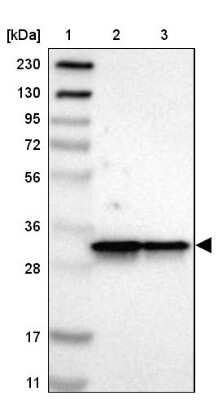 Western Blot: ARPC2 Antibody [NBP1-88852] - Lane 1: Marker  [kDa] 230, 130, 95, 72, 56, 36, 28, 17, 11.  Lane 2: Human cell line RT-4.  Lane 3: Human cell line U-251MG sp