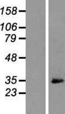 Western Blot: ARPC2 Overexpression Lysate (Adult Normal) [NBP2-07714] Left-Empty vector transfected control cell lysate (HEK293 cell lysate); Right -Over-expression Lysate for ARPC2.