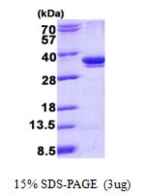 SDS-Page: Recombinant Human ARPC2 Protein [NBP2-22668]