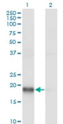 Western Blot: ARPC3 Antibody (2E11) [H00010094-M06] - Analysis of ARPC3 expression in transfected 293T cell line by ARPC3 monoclonal antibody (M06), clone 2E11. Lane 1: ARPC3 transfected lysatE (20.5 KDa). Lane 2: Non-transfected lysate.