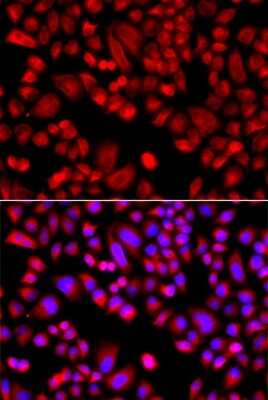 Immunocytochemistry/Immunofluorescence: ARPC3 Antibody [NBP2-92679] - Analysis of A549 cells using ARPC3 . Blue: DAPI for nuclear staining.