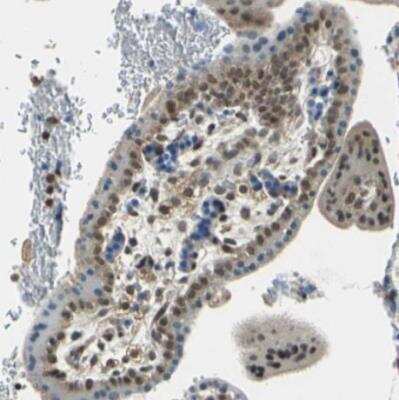 Immunohistochemistry-Paraffin: ARPC3 Antibody [NBP1-89016] - Staining of human placenta shows moderate nuclear positivity in trophboblastic cells.