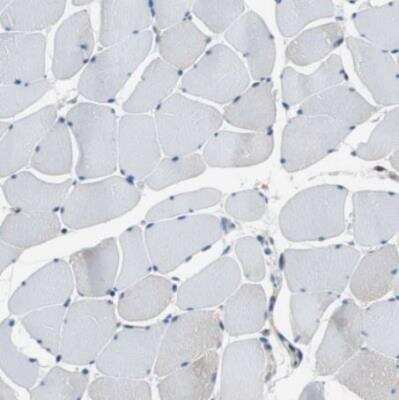 Immunohistochemistry-Paraffin: ARPC3 Antibody [NBP1-89016] - Staining of human skeletal muscle shows no positivity in myocytes as expected.