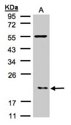 Western Blot: ARPC3 Antibody [NBP1-31422] - Sample(30 ug of whole cell lysate) A:Raji 12% SDS PAGE, antibody diluted at 1:500.