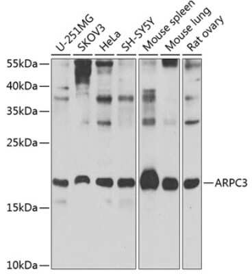 Western Blot: ARPC3 Antibody [NBP2-92679] - Analysis of extracts of various cell lines, using ARPC3 at 1:1000 dilution.Secondary antibody: HRP Goat Anti-Rabbit IgG (H+L) at 1:10000 dilution.Lysates/proteins: 25ug per lane.Blocking buffer: 3% nonfat dry milk in TBST.Detection: ECL Basic Kit .Exposure time: 30s.