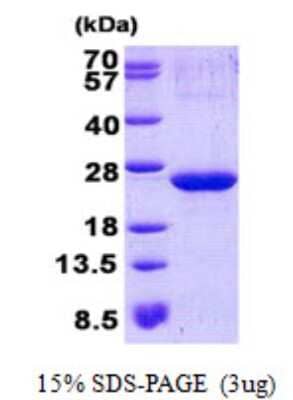SDS-PAGE Recombinant Human ARPC3 His Protein