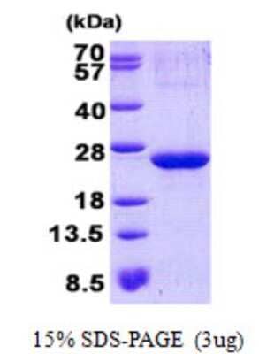 SDS-Page: ARPC3 Protein [NBP2-22669]