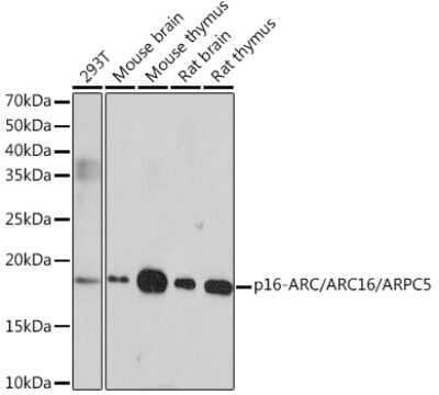 Western Blot: ARPC5 Antibody (7W9M7) [NBP3-16483] - Western blot analysis of extracts of various cell lines, using ARPC5 Rabbit mAb (NBP3-16483) at 1:1000 dilution. Secondary antibody: HRP Goat Anti-Rabbit IgG (H+L) at 1:10000 dilution. Lysates/proteins: 25ug per lane. Blocking buffer: 3% nonfat dry milk in TBST. Detection: ECL Enhanced Kit. Exposure time: 3min.
