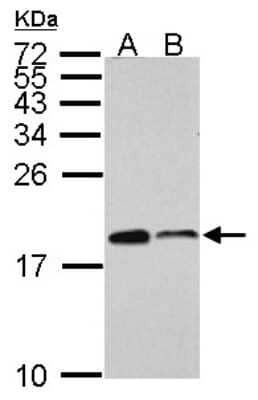 Western Blot ARPC5 Antibody