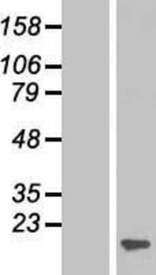 Western Blot ARPC5 Overexpression Lysate