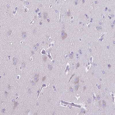 Immunohistochemistry-Paraffin: ARPM1 Antibody [NBP1-90910] - Staining of human cerebral cortex shows moderate cytoplasmic positivity in neuronal cells.