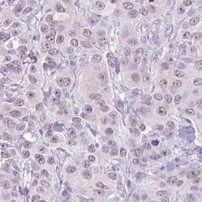 Immunohistochemistry-Paraffin ARPM1 Antibody - BSA Free