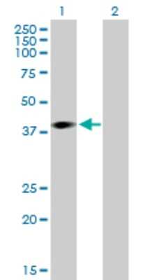 Western Blot: ARPM1 Antibody [H00084517-B01P] - Analysis of ARPM1 expression in transfected 293T cell line by ARPM1 polyclonal antibody.  Lane 1: ARPM1 transfected lysate(40.92 KDa). Lane 2: Non-transfected lysate.