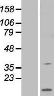 Western Blot: ARPP-21 Overexpression Lysate (Adult Normal) [NBP2-11225] Left-Empty vector transfected control cell lysate (HEK293 cell lysate); Right -Over-expression Lysate for ARPP-21.