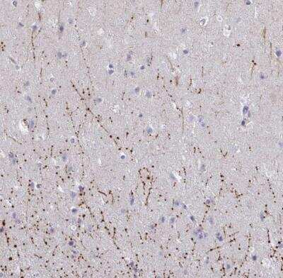 Immunohistochemistry-Paraffin ARPP19 Antibody