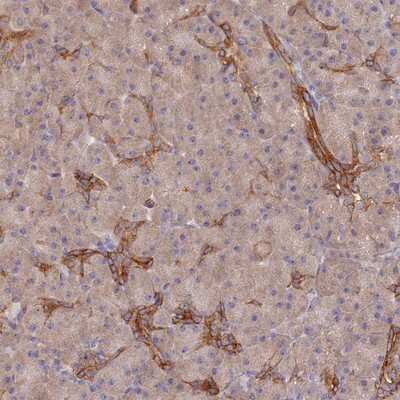 Immunohistochemistry-Paraffin: ARRDC1 Antibody [NBP1-91683] - Staining of human pancreas shows distinct cytoplasmic positivity in ducts.