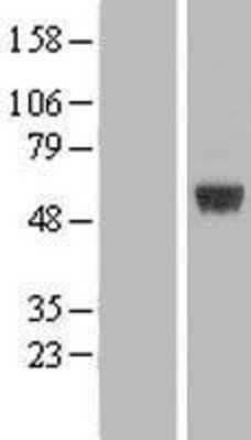 Western Blot: ARRDC1 Overexpression Lysate (Adult Normal) [NBL1-07734] Left-Empty vector transfected control cell lysate (HEK293 cell lysate); Right -Over-expression Lysate for ARRDC1.