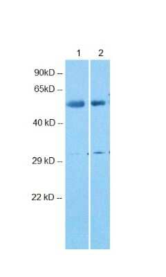 Western Blot: ARRDC4 Antibody [NBP2-82678] - Host: Rabbit. Target Name: ARRDC4. Sample Type: Lane 1: human lung. Lane 2: human liver. Antibody Dilution: 1.0ug/ml