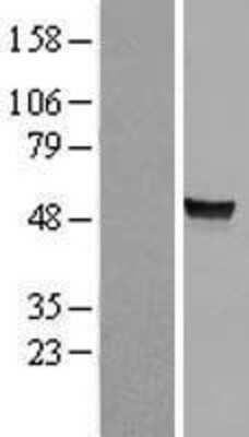 Western Blot: Arylsulfatase A/ARSA Overexpression Lysate [NBP2-08437] -  Left-Empty vector transfected control cell lysate (HEK293 cell lysate); Right -Over-expression Lysate for ARSA.