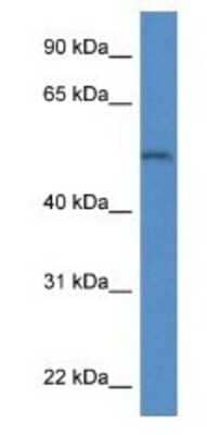 Western Blot: Arylsulfatase B/ARSB Antibody [NBP1-79727] -  Mouse Kidney Lysate 1ug/ml  Gel Concentration 12%