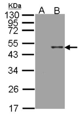 Western Blot: Arylsulfatase B/ARSB Antibody [NBP2-15474] -  Analysis of ARSB expression in transfected 293T cell line by ARSB polyclonal antibody. A: Non-transfected lysate. B: ARSB transfected lysate. 12% SDS PAGE gel, diluted at 1:500.