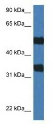 Western Blot: Arylsulfatase G/ARSG Antibody [NBP1-79576] - Mouse Spleen Lysate 1ug/ml  Gel Concentration 12%