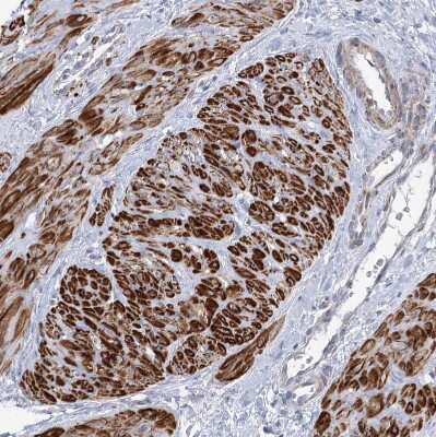 Immunohistochemistry-Paraffin ARSI Antibody