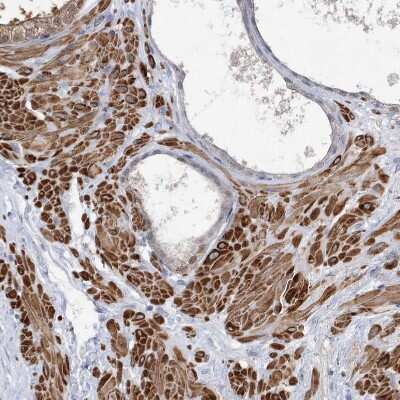 Immunohistochemistry-Paraffin: ARSI Antibody [NBP2-48681] - Staining of human prostate shows strong cytoplasmic positivity in smooth muscle cells.