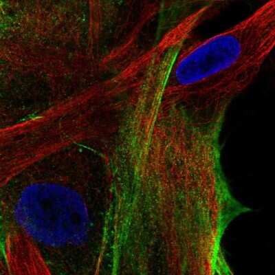 Immunocytochemistry/Immunofluorescence: ARSJ Antibody [NBP1-82070] - Staining of human cell line BJ shows localization to actin filaments.