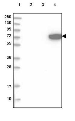 Western Blot ARSJ Antibody