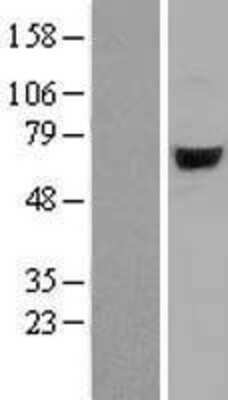 Western Blot: ARSJ Overexpression Lysate (Adult Normal) [NBL1-07742] Left-Empty vector transfected control cell lysate (HEK293 cell lysate); Right -Over-expression Lysate for ARSJ.