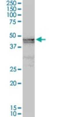 Western Blot: ART3 Antibody [H00000419-D01P] - Analysis of ART3 expression in mouse testis.