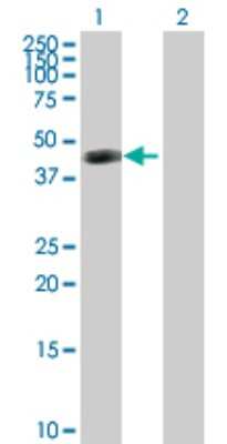 Western Blot: ART3 Antibody [H00000419-D01P] - Analysis of ART3 expression in transfected 293T cell line by ART3 polyclonal antibody.Lane 1: ART3 transfected lysate(42.70 KDa).Lane 2: Non-transfected lysate.