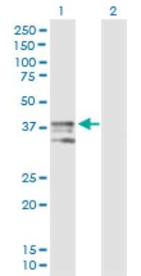 Western Blot: ART4 Antibody [H00000420-B01P] - Analysis of ART4 expression in transfected 293T cell line by ART4 polyclonal antibody.  Lane 1: ART4 transfected lysate(34.54 KDa). Lane 2: Non-transfected lysate.