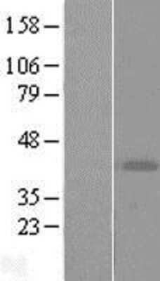 Western Blot ART4 Overexpression Lysate