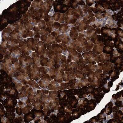 Immunohistochemistry: ART5 Antibody [NBP2-48744] - Staining of human pancreas shows strong cytoplasmic positivity in exocrine glandular cells.