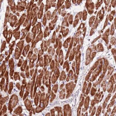 Immunohistochemistry: ART5 Antibody [NBP2-48808] - Staining of human heart muscle shows strong cytoplasmic positivity in myocytes.