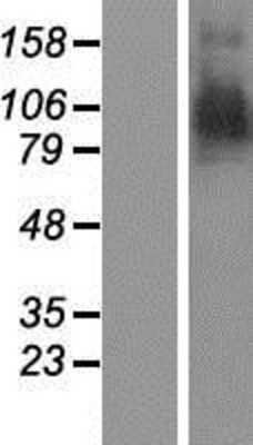 Western Blot: Aminopeptidase PILS/ARTS1 Overexpression Lysate [NBP2-11195] - Left-Empty vector transfected control cell lysate (HEK293 cell lysate); Right -Over-expression Lysate for ARTS1.