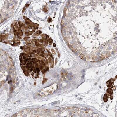 Immunohistochemistry-Paraffin ARV1 Antibody - BSA Free