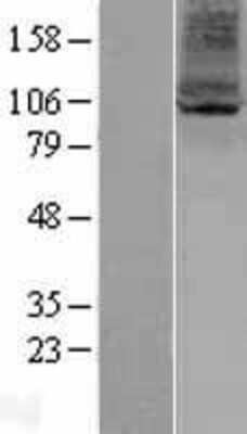 Western Blot: ARV1 Overexpression Lysate (Adult Normal) [NBP2-04390] Left-Empty vector transfected control cell lysate (HEK293 cell lysate); Right -Over-expression Lysate for ARV1.
